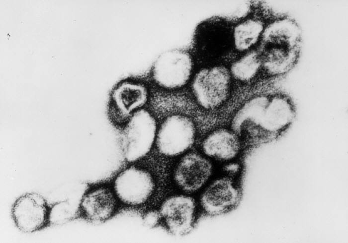 Rubella virus - Wikipedia