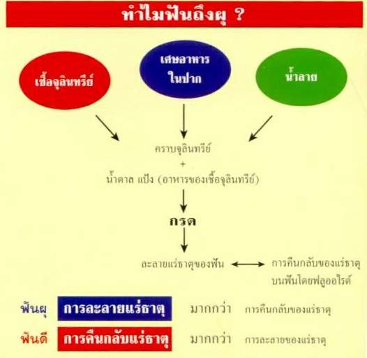 ทำไมฟันถึงผุ